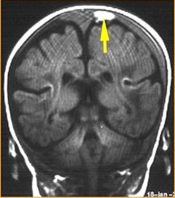 What is your diagnosis??
