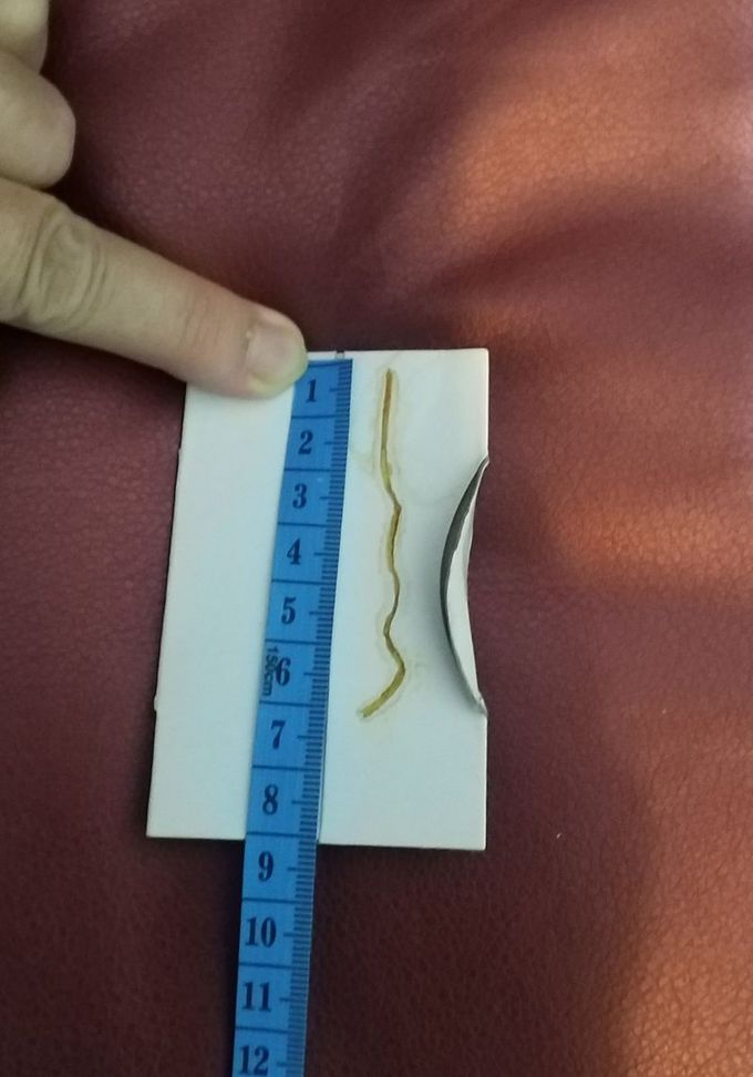 What type of worm is this?