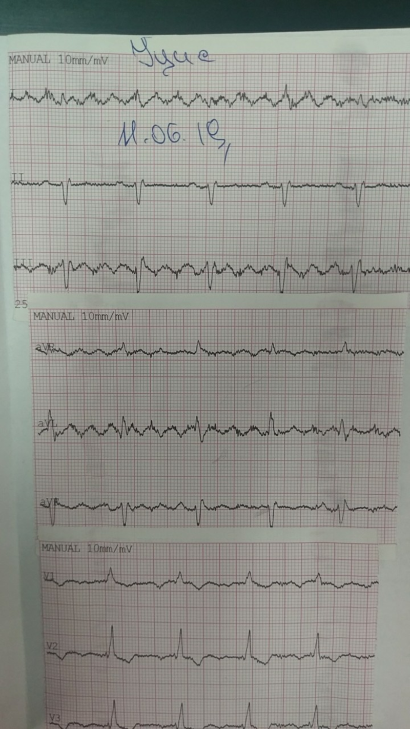 Cardiology ecg ekg - MEDizzy