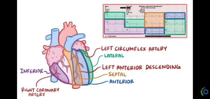 Cardiac