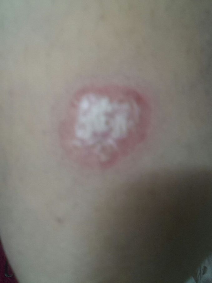 What is your diagnosis?