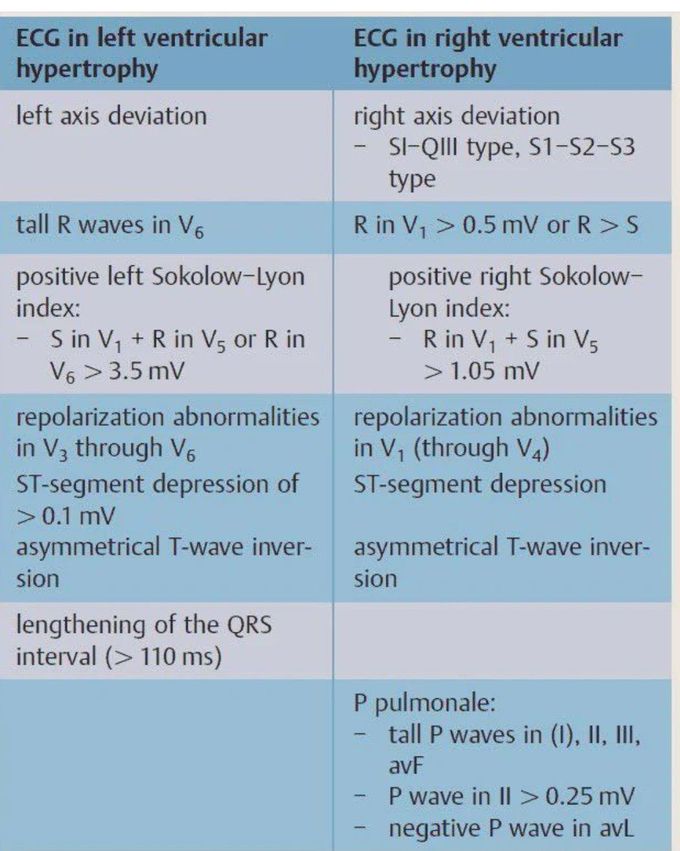 ECG in Ventricular Hypertrophy