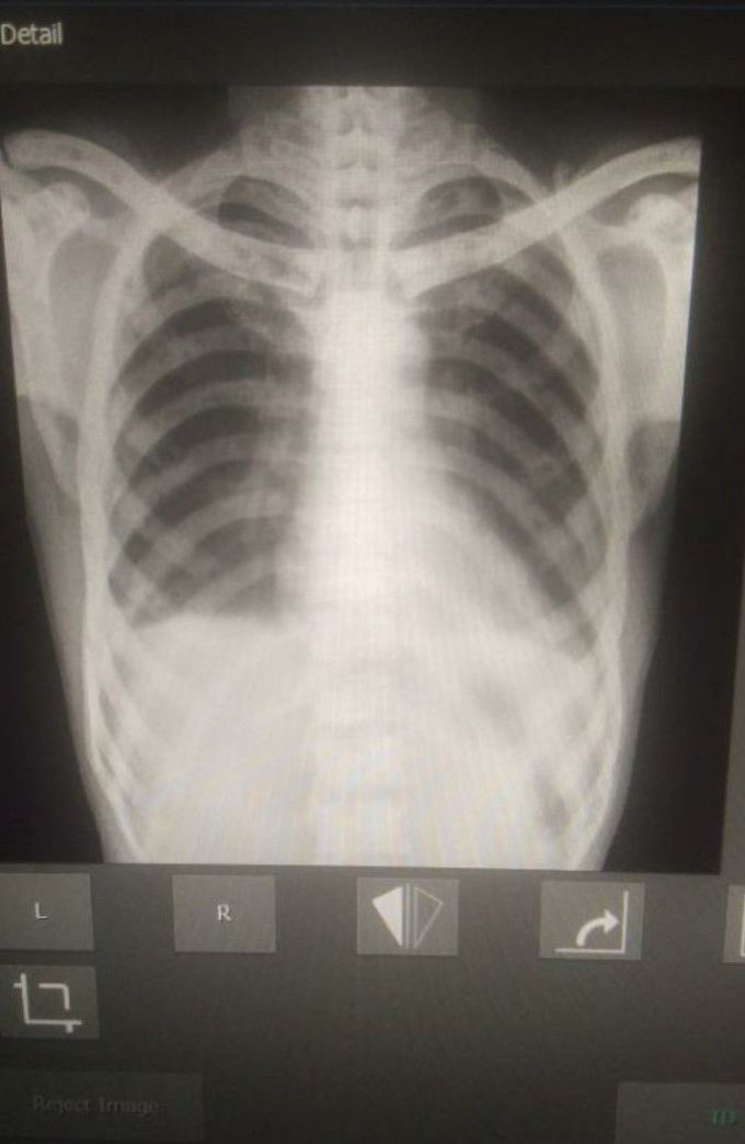 Frd pls help me to diagnosis....