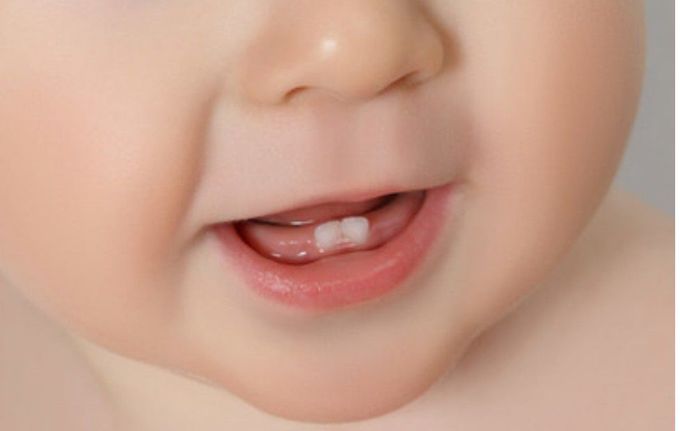 Tips To Improve Your Kids Dental Hygiene