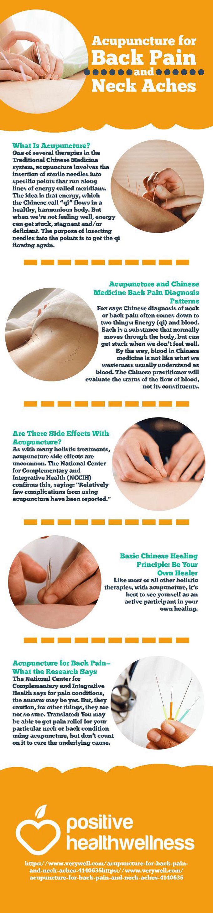 Accupuncture