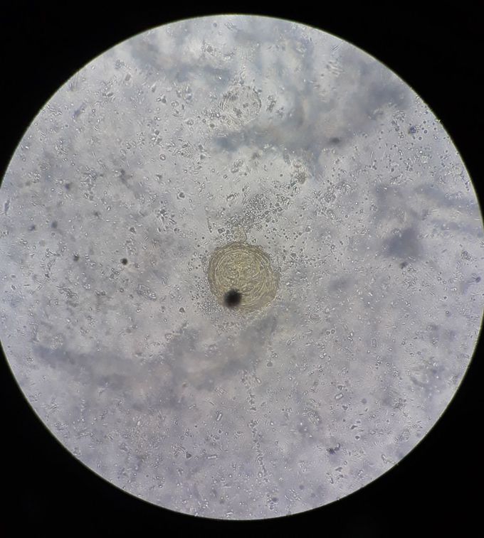 Ascaris lumbricoides ova