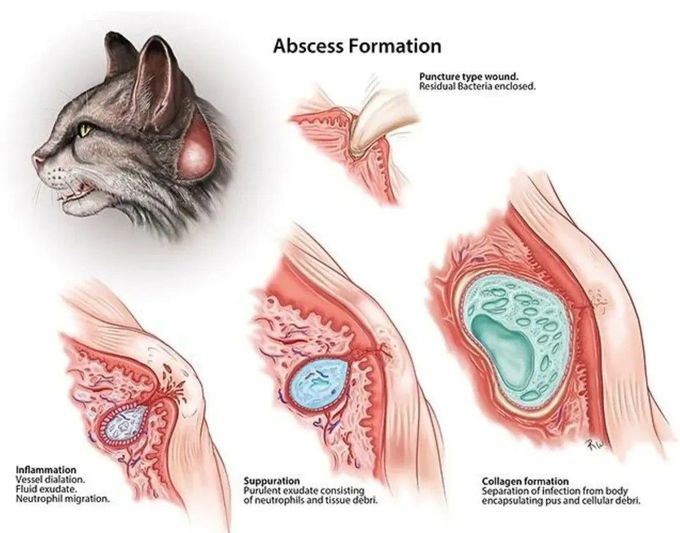 Cat Bite Abscess