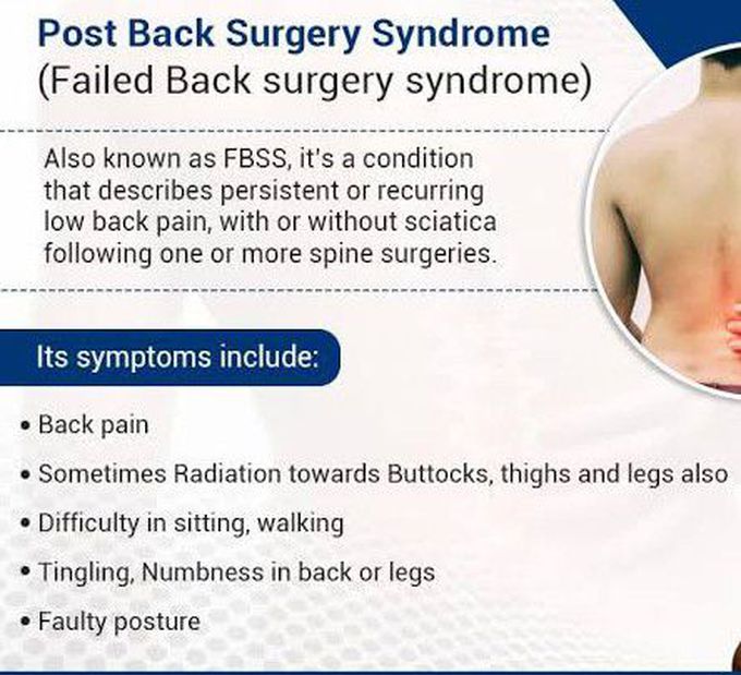 These are the symptoms of post back surgery syndrome