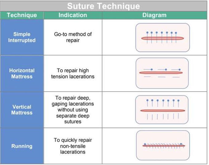 Suture Technique