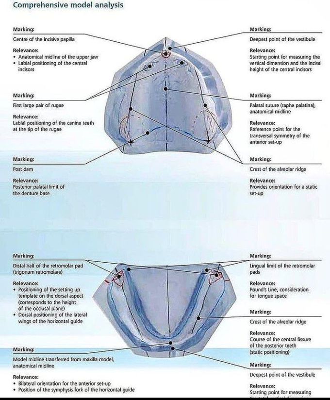 Landmarks of mandible and maxilla