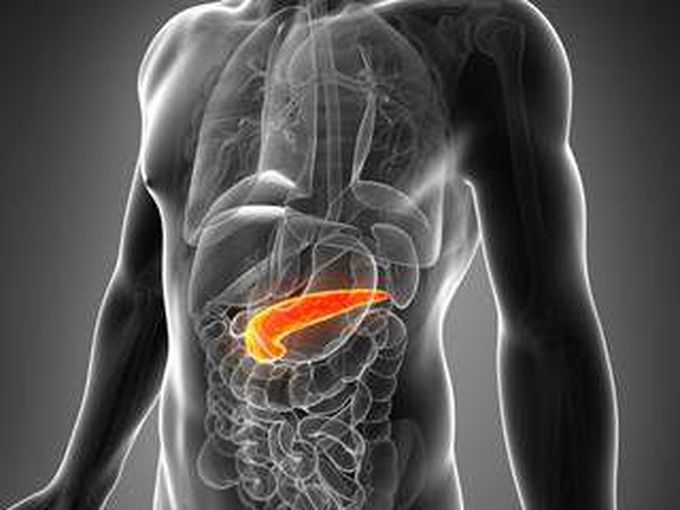 Acute pancreatitis
