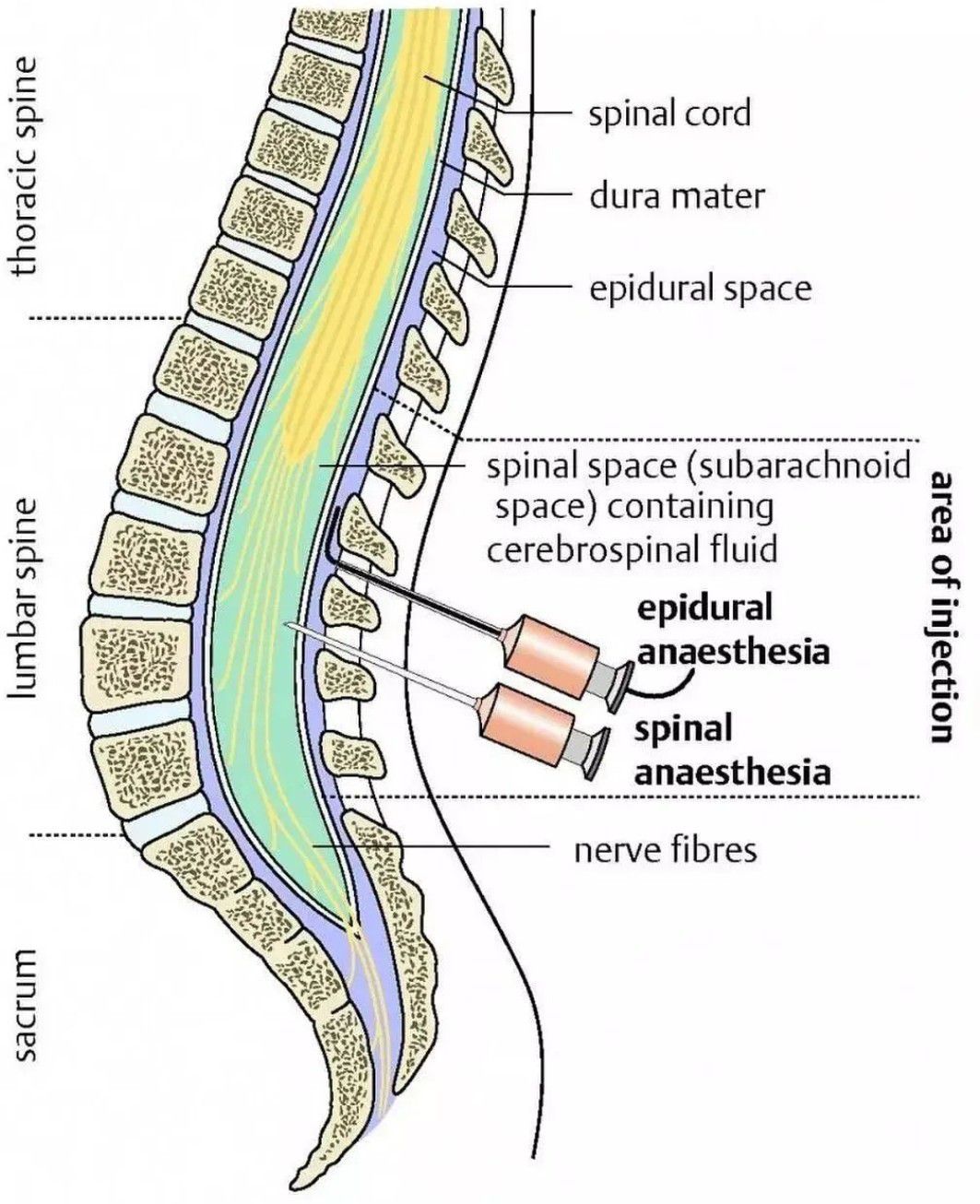 Spinal and Epidural Anesthesia - MEDizzy