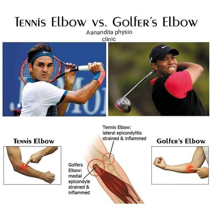 Tennis and Golfer's Elbow MEDizzy