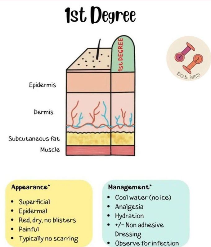 1st Degree Burn