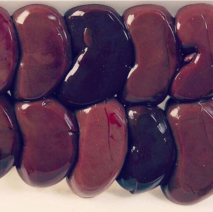 What is the size of the kidney ??                                    A) 4-5in                                                                                 B)10-12in.                                                                              C)11-20in