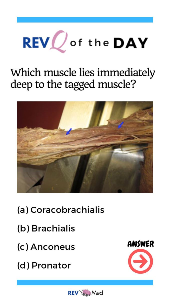Cadaver Arm Q&A