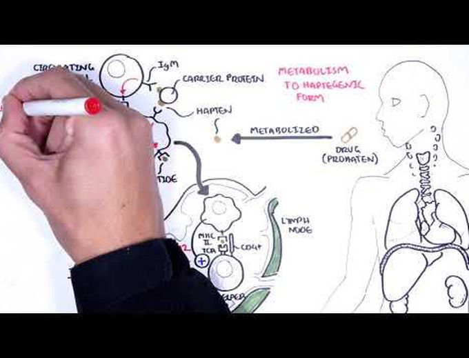 DRESS Syndrome  - causes, pathophysiology, signs and symptoms, treatment