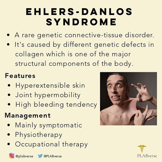 Ehlers-Danlos syndrome