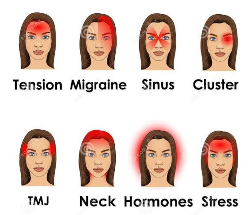 Types of headaches - MEDizzy