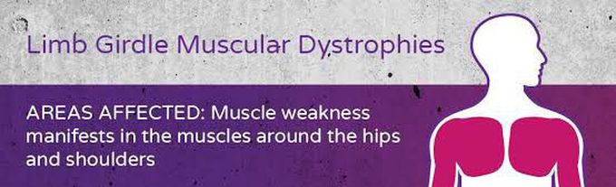 Limb girdle muscular dystrophy