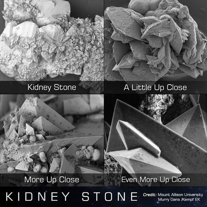 magnified stones