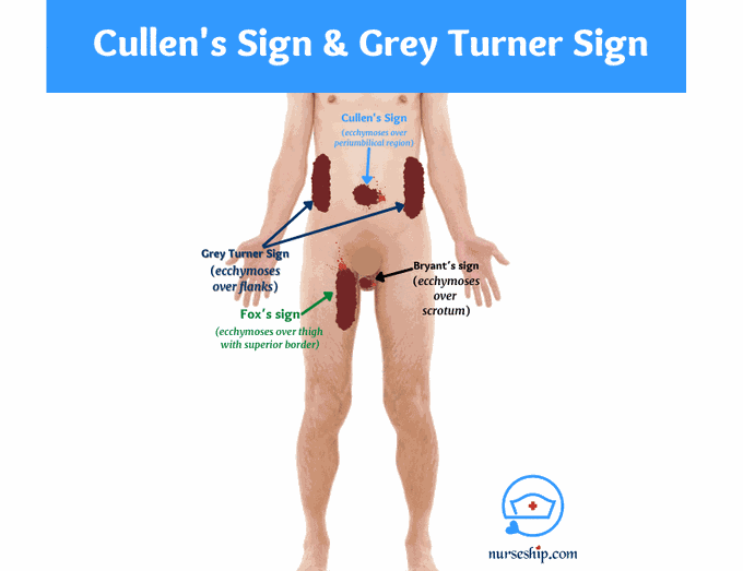 Important Clinical Signs
