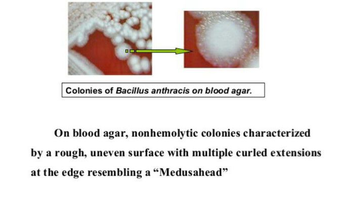 Bacillus anthracis- culture characteristics