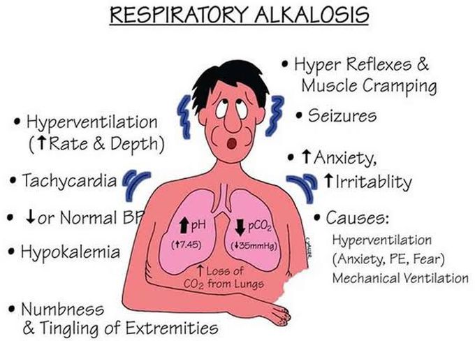 Respiratory Alkalosis