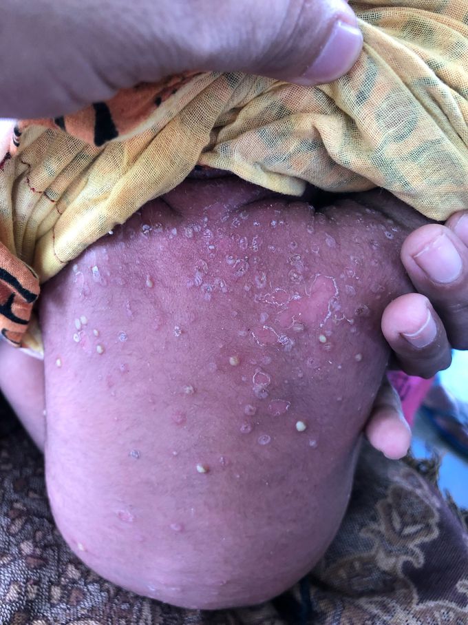 SPOT DIAGNOSIS