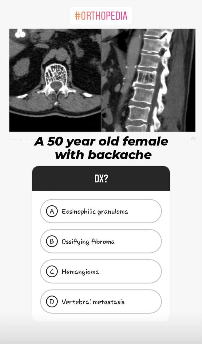 Correct answer??