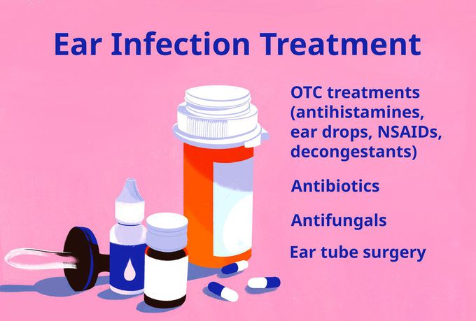 How is an ear infection treated?