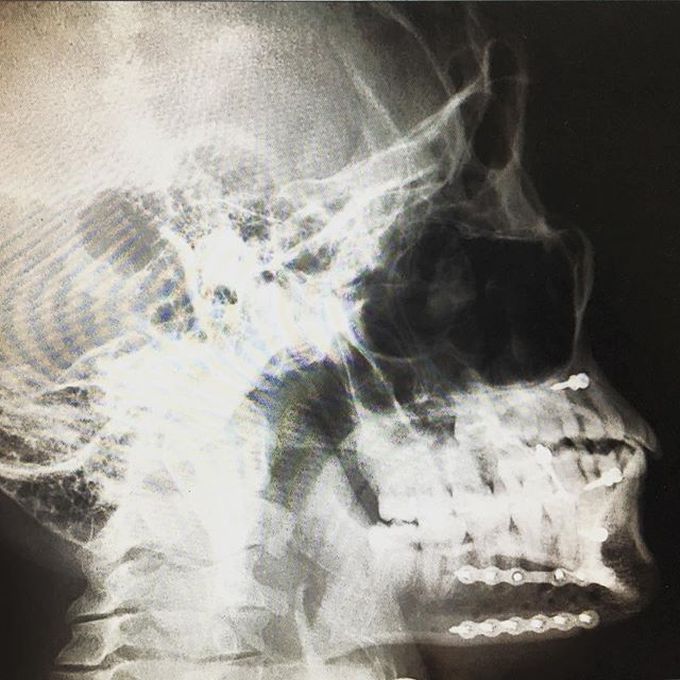 The Radiographic Mugshot 💀• 