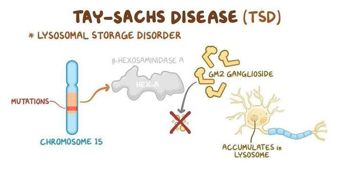 Tay Sachs disease