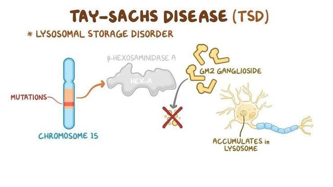 Tay Sachs disease - MEDizzy