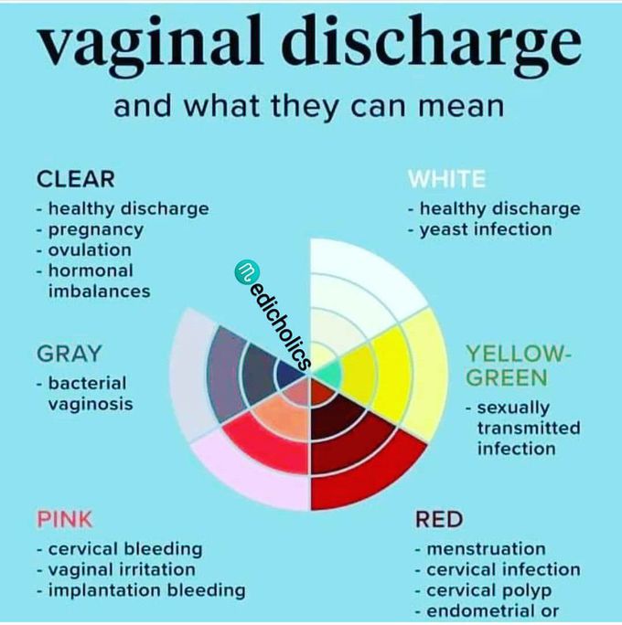 Vaginal discharge