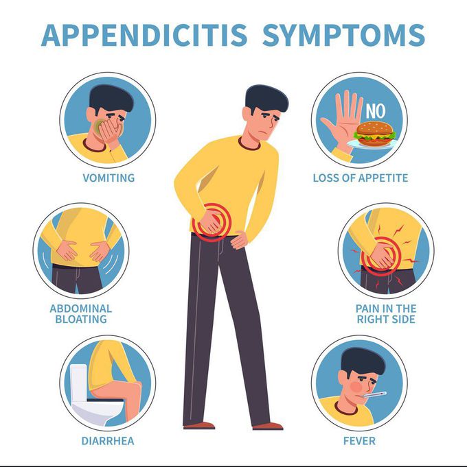 Appendictis