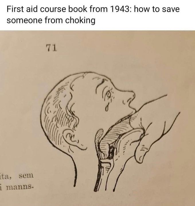 First aid for choking back in the days
