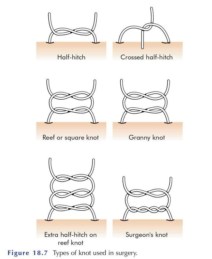 types of knots used in surgery