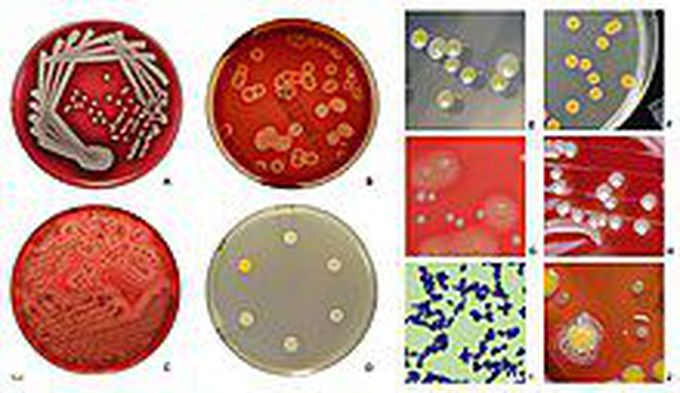 Staphylococcus aureus is a Gram-positive round-shaped bacterium, a member of the Bacillota, and is a usual member of the microbiota of the body, frequently found in the upper respiratory tract and on the skin. It is often positive for catalase and nitrate reduction and is a facultative anaerobe that can grow without the need for oxygen.[1] Although S. aureus usually acts as a commensal of the human microbiota, it can also become an opportunistic pathogen, being a common cause of skin infections including abscesses, respiratory infections such as sinusitis, and food poisoning. Pathogenic strains often promote infections by producing virulence factors such as potent protein toxins, and the expression of a cell-surface protein that binds and inactivates antibodies. S. aureus is one of the leading pathogens for deaths associated with antimicrobial resistance and the emergence of antibiotic-resistant strains such as methicillin-resistant S. aureus (MRSA) is a worldwide problem in clinical medicine. Despite much research and development, no vaccine for S. aureus has been approved.