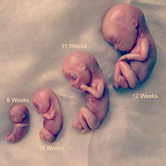 Different stages of fetal developmental