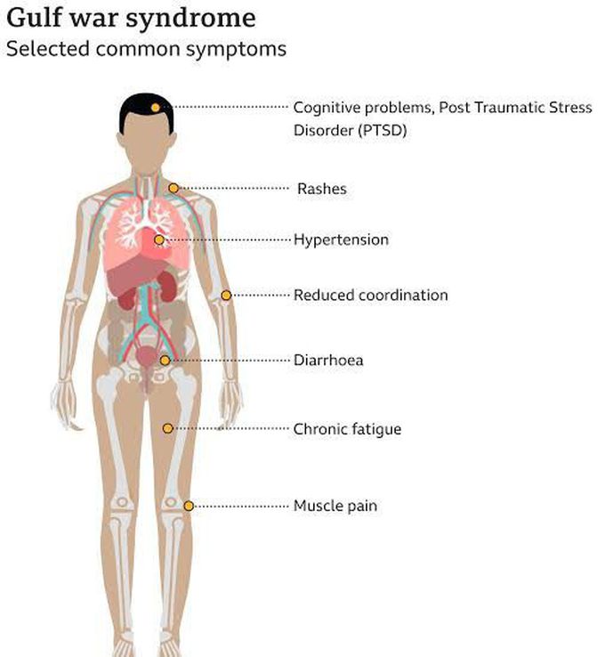 These are the symptoms of Gulf war syndrome