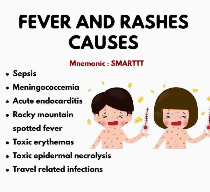 Fever and rash-causes - MEDizzy