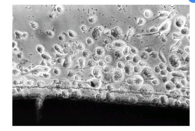 Cytotoxic interaction