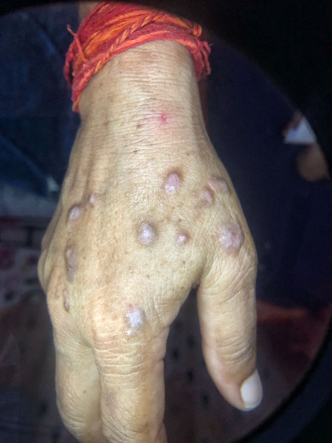 Dermatology