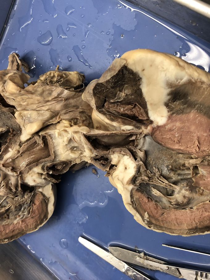 Heart Dissection 