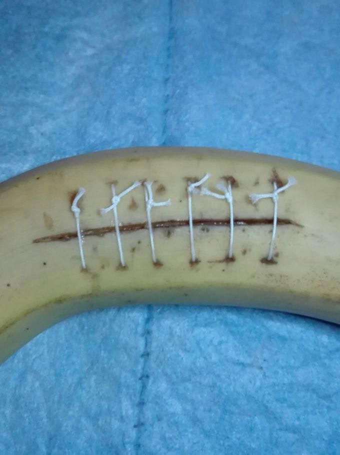 Is it good suture ?