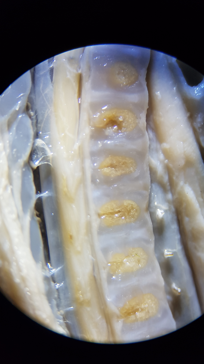 Nucleos de osificación columna vertebral.