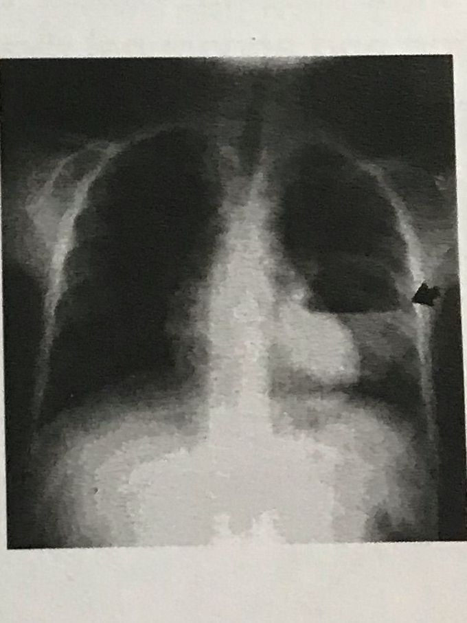 Diagnosis ??