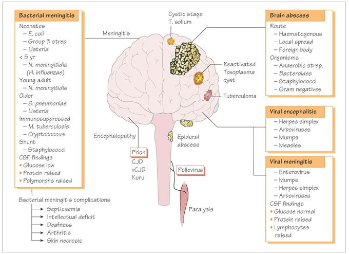 Cerebral infections