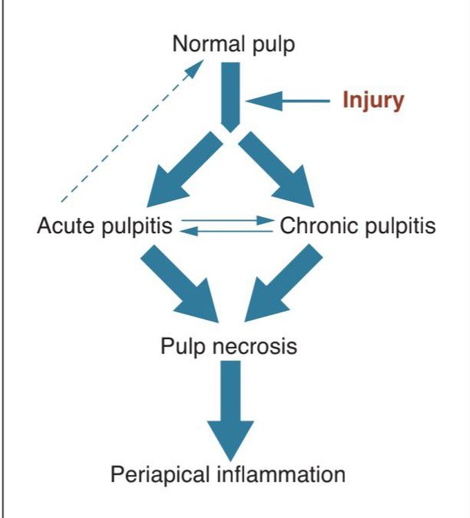 Pulpitis pathways